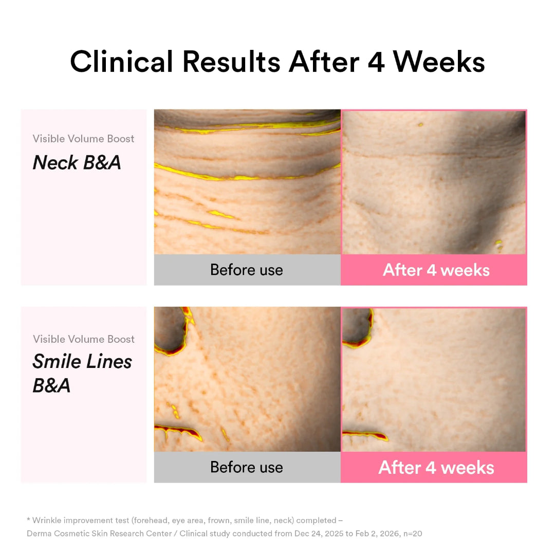 [ABIB] PDRN Volume Fill-It Booster Cream 2.5 Tube 30ML